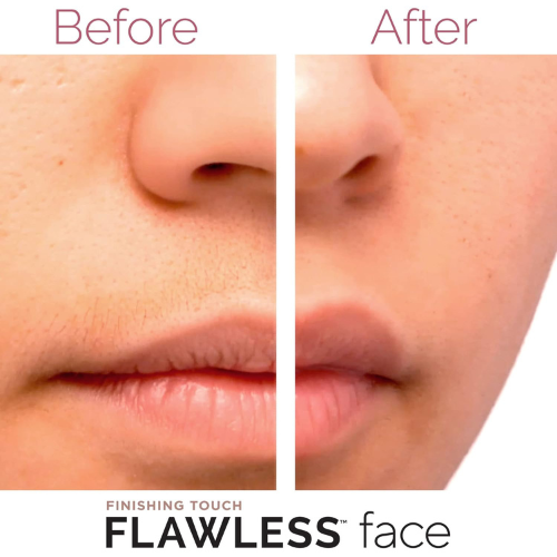 Título optimizado: Finishing Touch Flawless – Removedor de Vello Facial sin Dolor para Mujer, Rose Gold